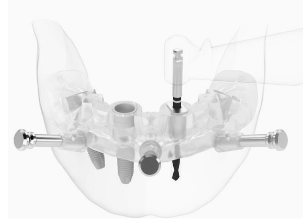 ノーベルガイドシステム